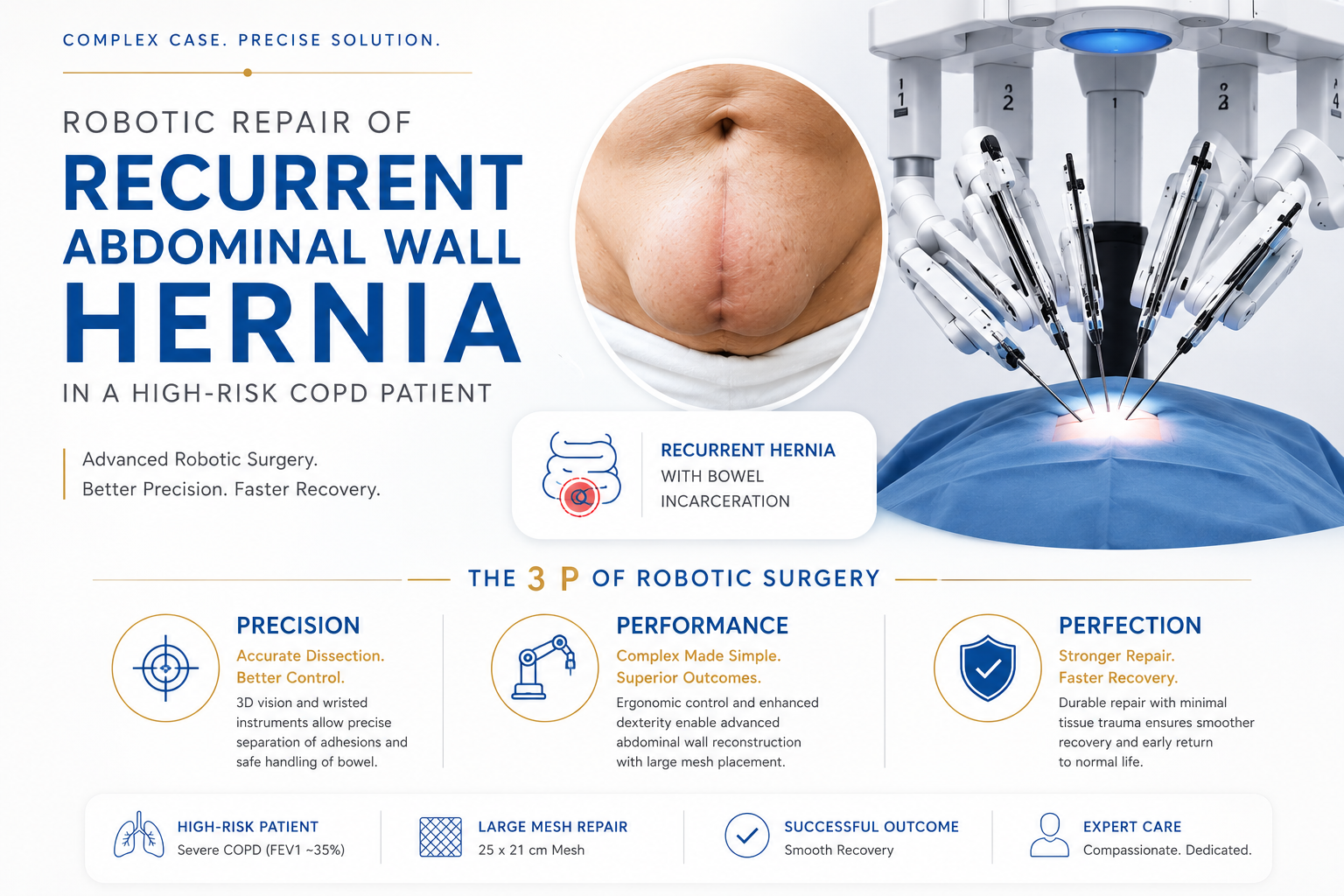 Robotic Repair of a Recurrent Complex Lower Abdominal Wall Hernia in a High-Risk COPD Patient: Clinical Case #001